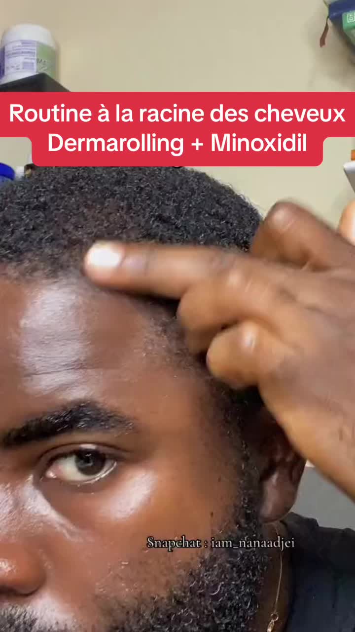 @Minoxidil DR Congo