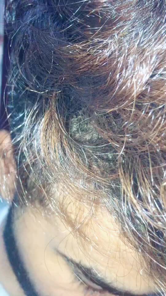 @13hairdoctor