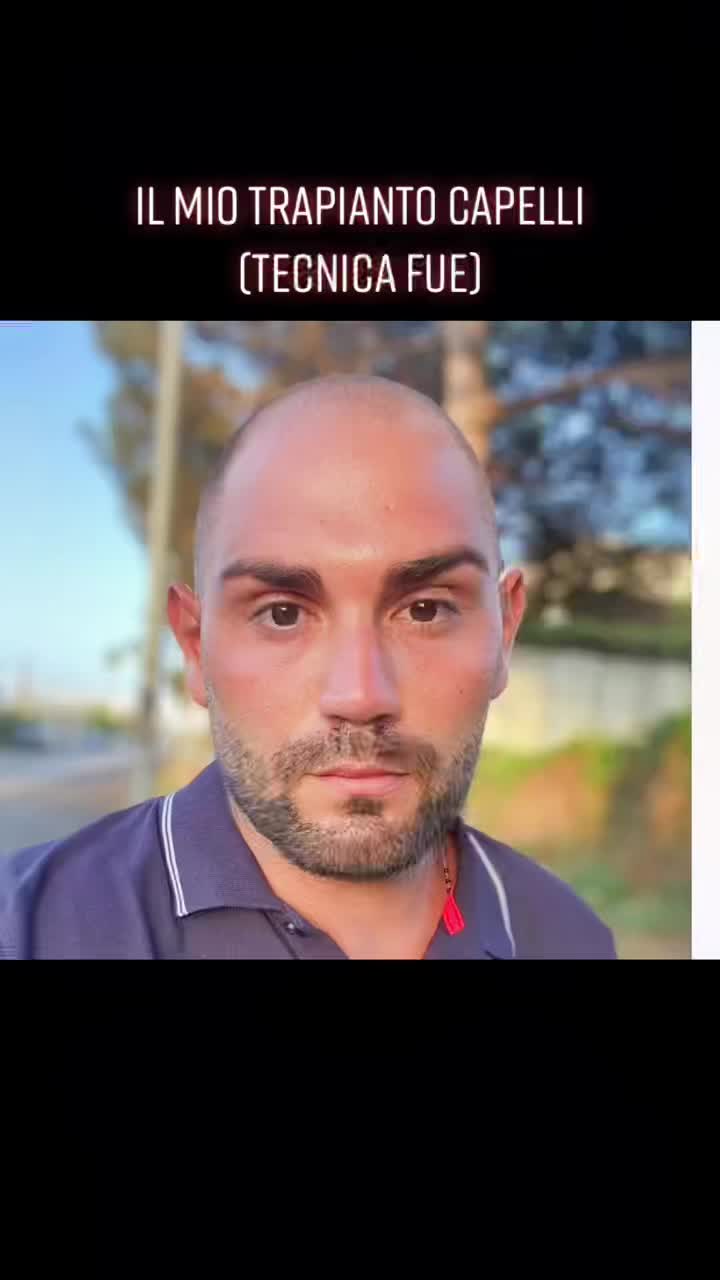 @Luigi Gallipari