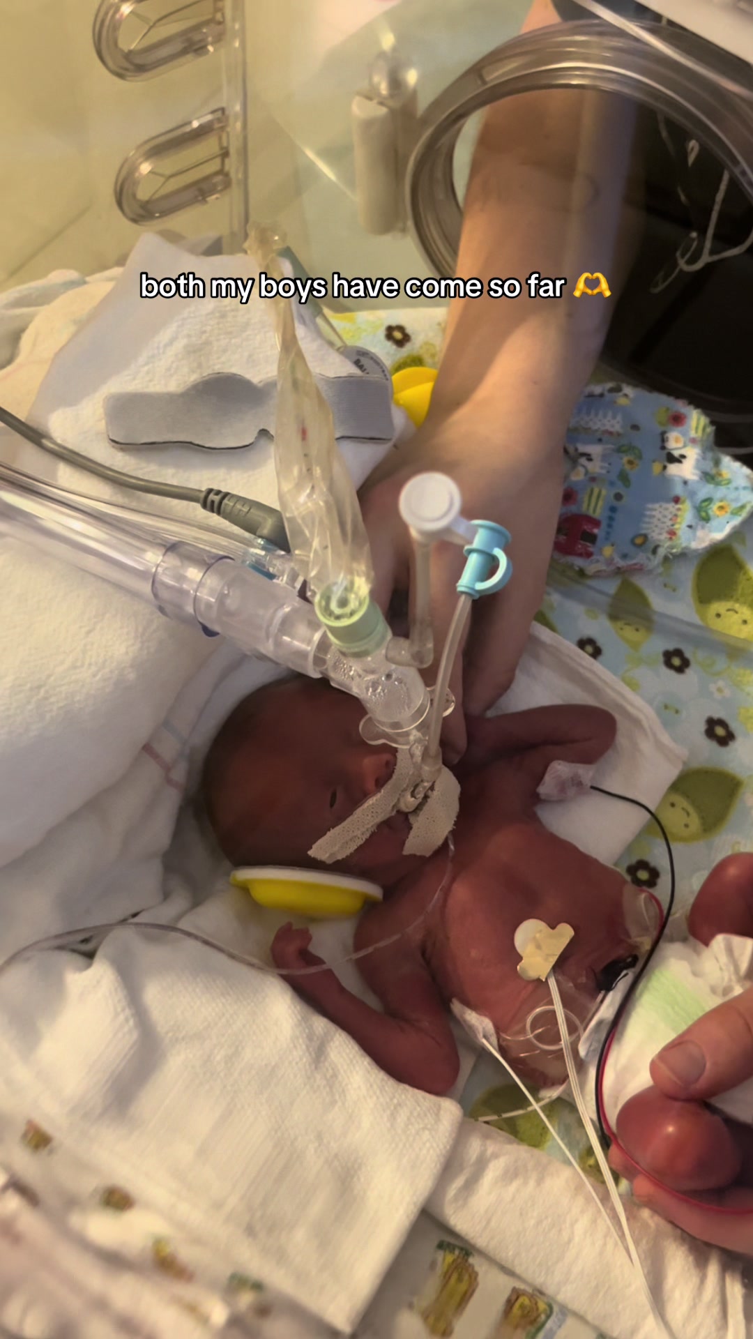 @Cassie | NICU friend