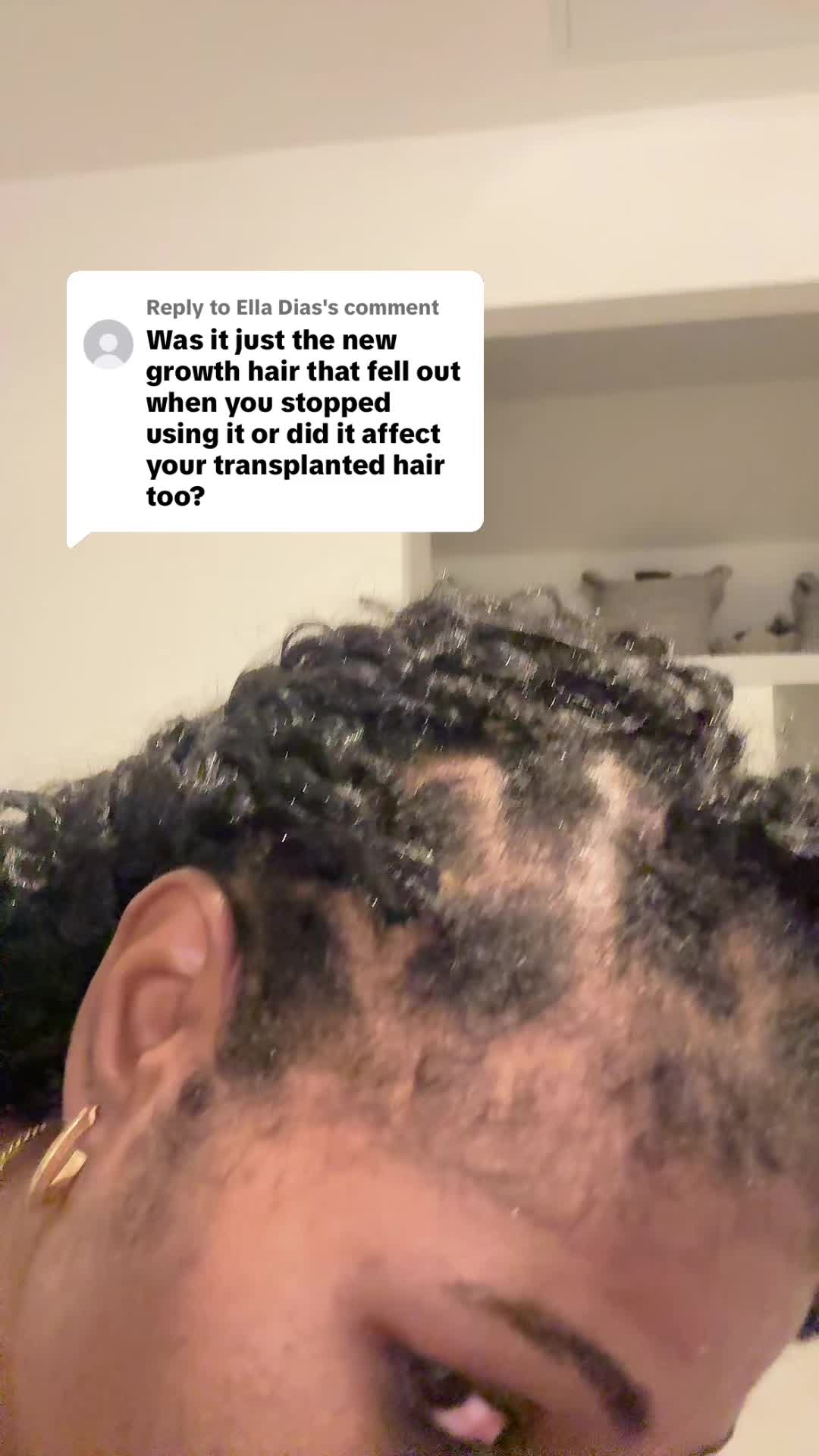 @Myafrotransplant