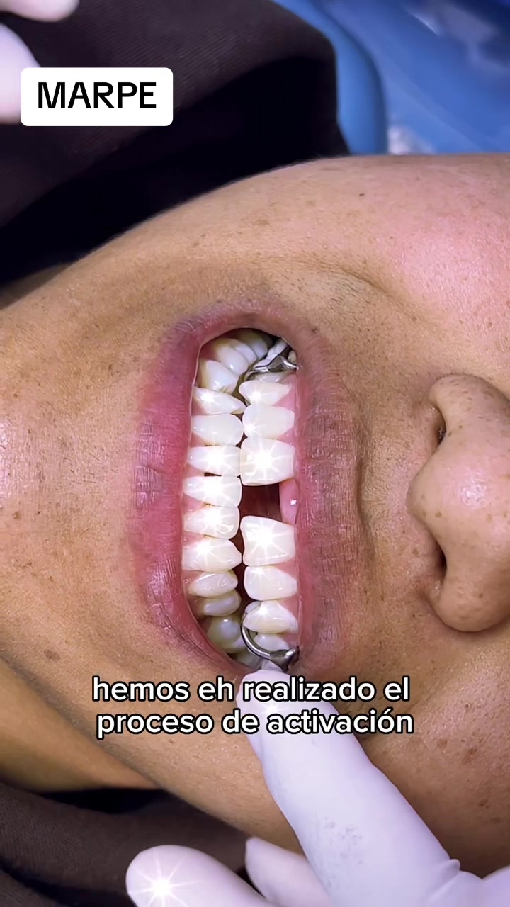 @DentikaBrackets