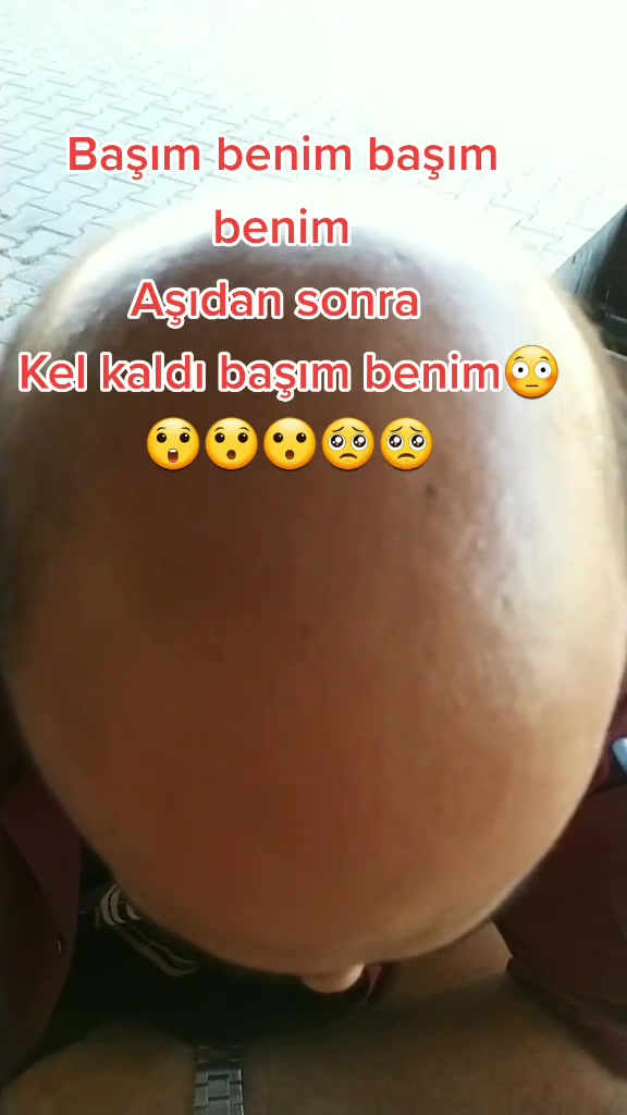 @Harun Karademir