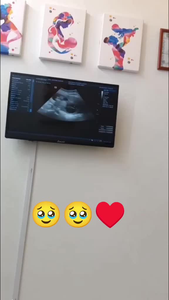 @Dalia Bautista