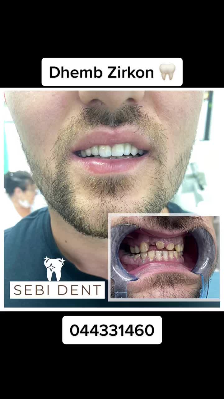 @sebi dent