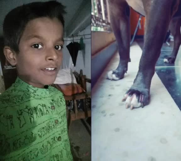 @Antha Reddy