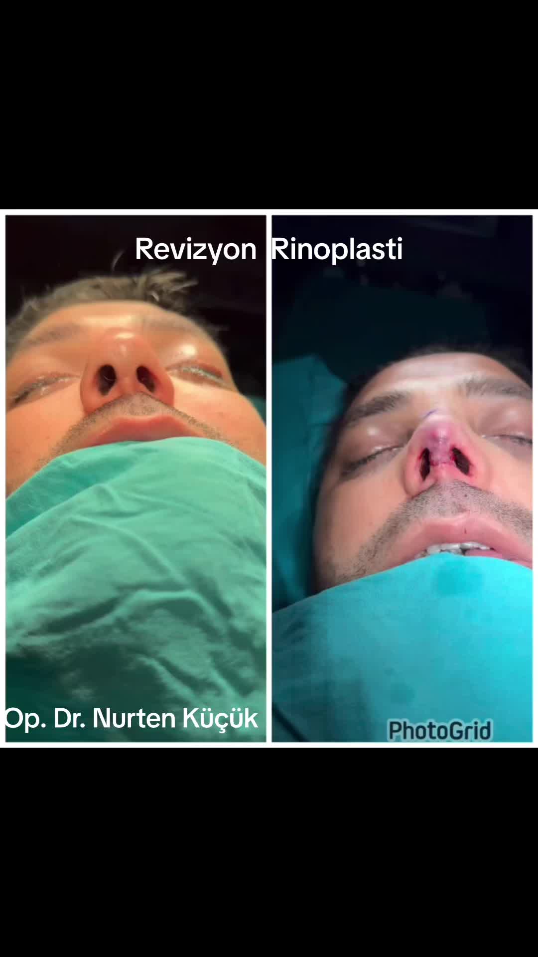 @Dr. NurtenKucuk