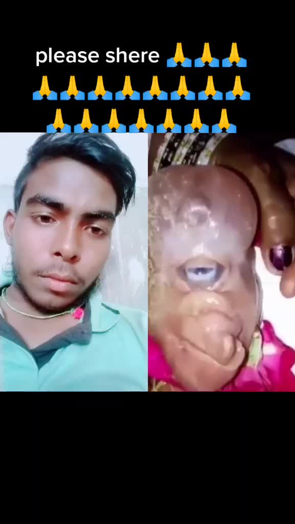 @Lalu Kumar thakur