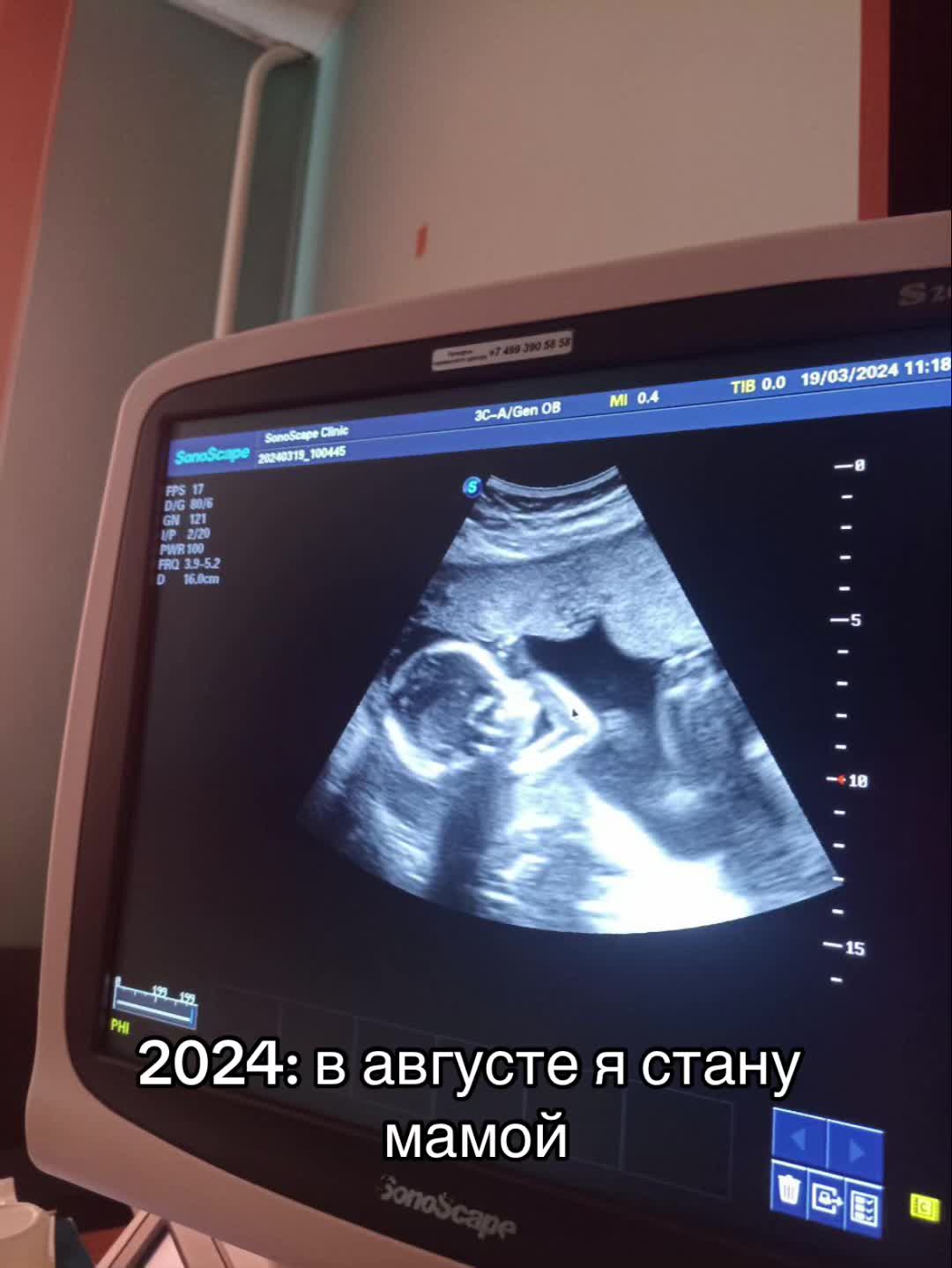 @ТГК: Просто я💄🫦