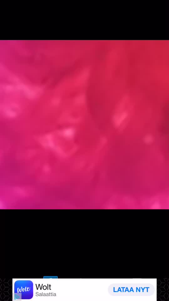 @editss