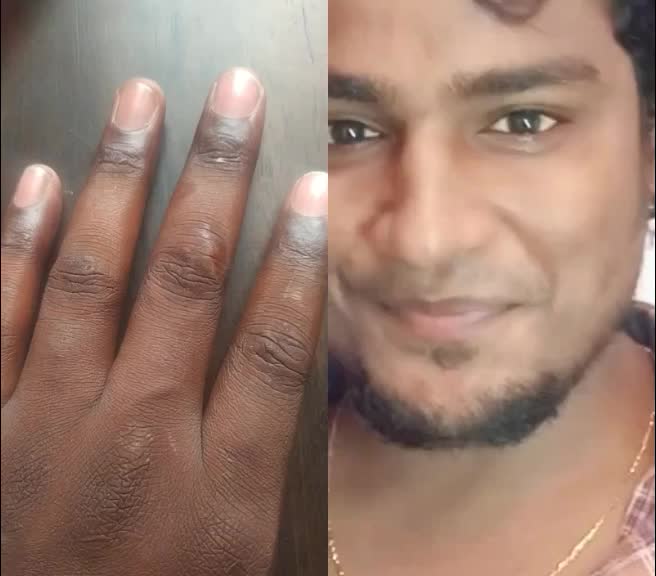 @Harish Yadhavan
