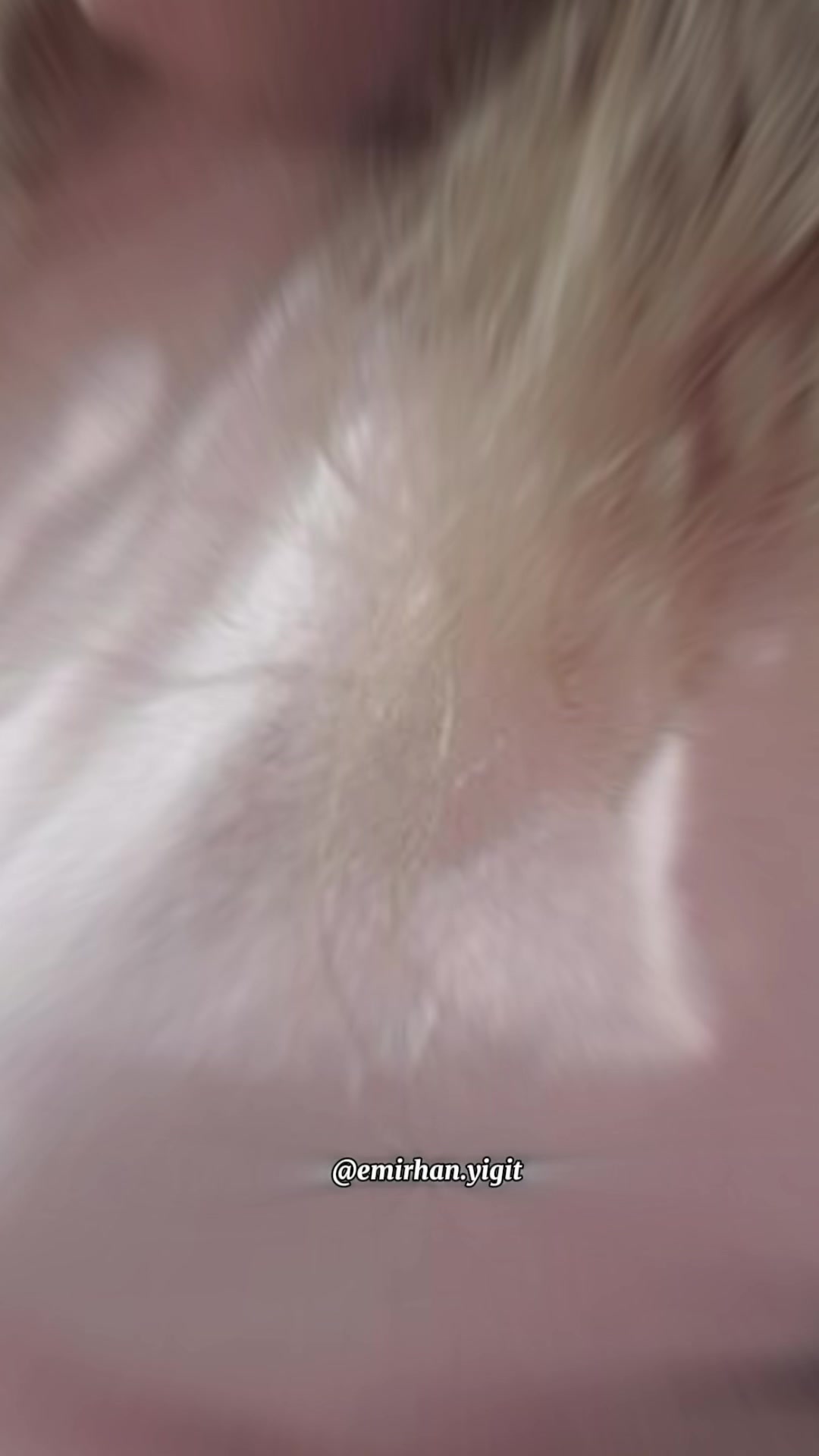 @user17187838309