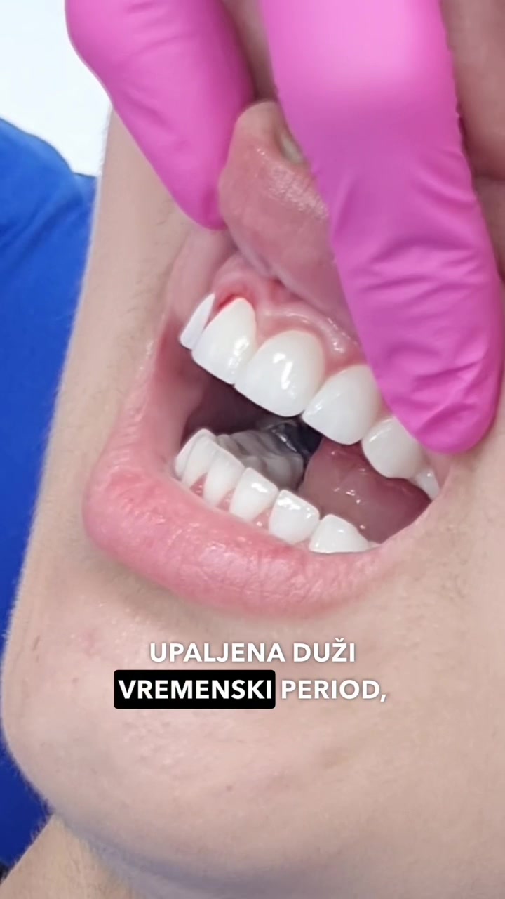 @Sarajdent