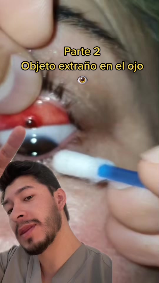@Doc👨🏻&zwj;⚕️Vision