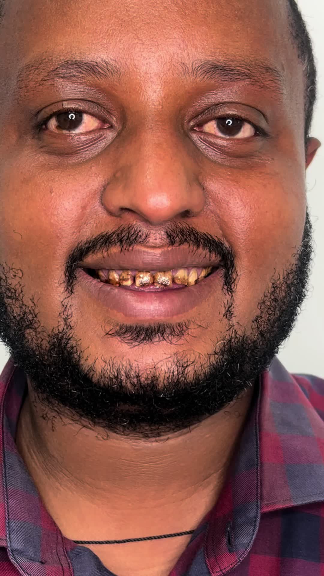 @drhelina_smile_architect