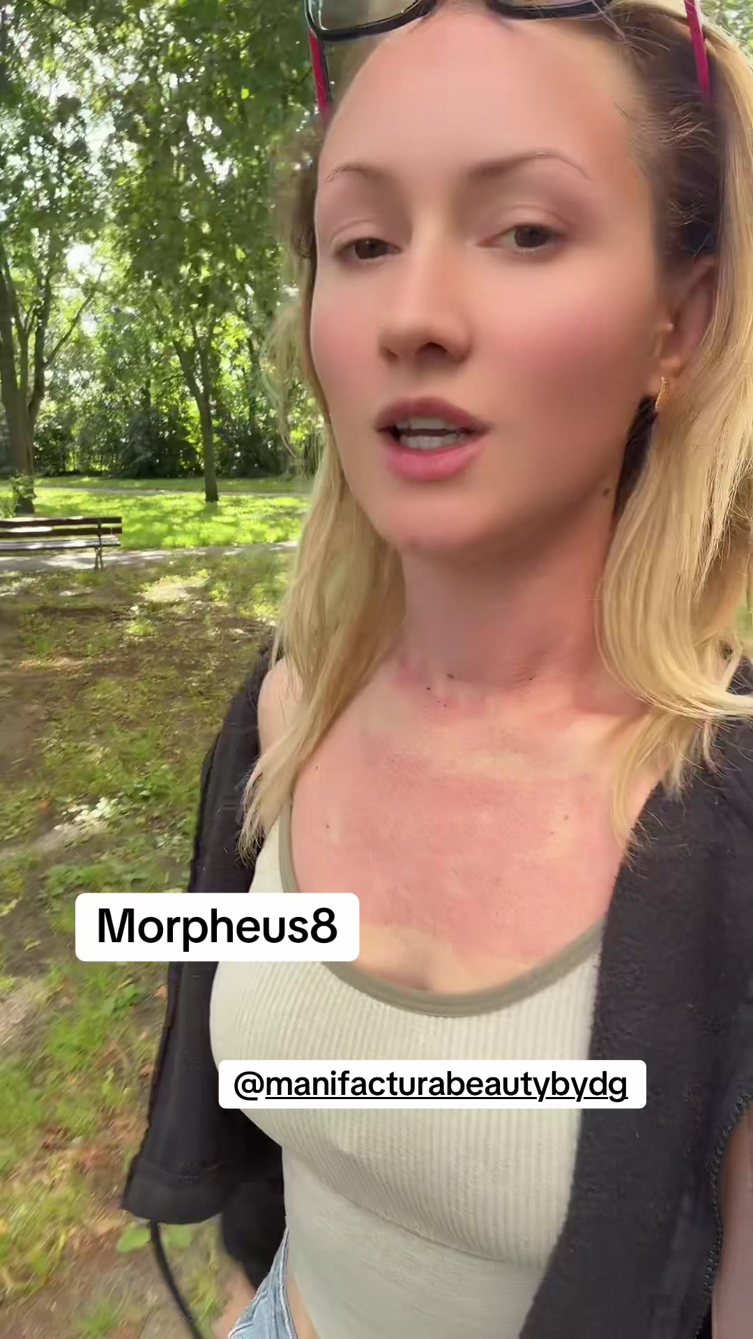 @Blonda