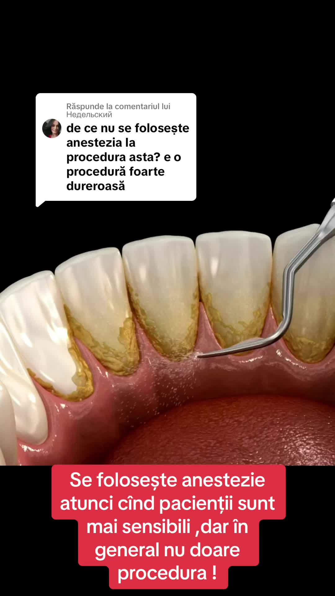 @Stomatolog Snejana Carabulea🦷