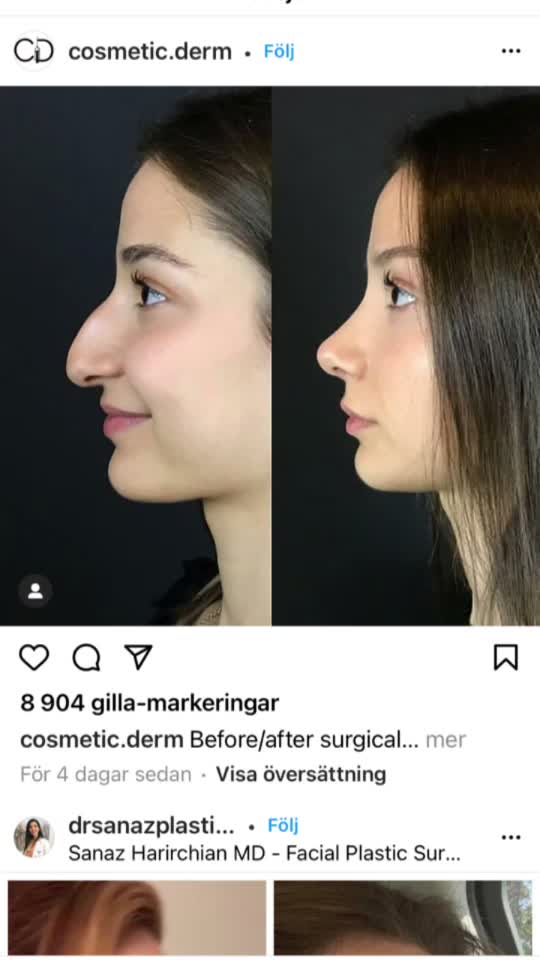 @Tovabruhn