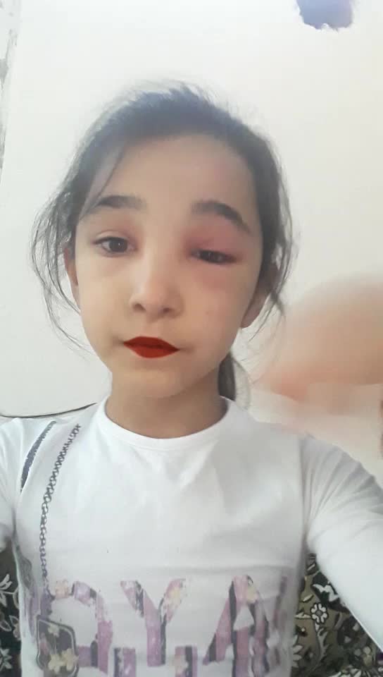 @XAİŞ EDİREM TAKİBATIN 1K OLUM