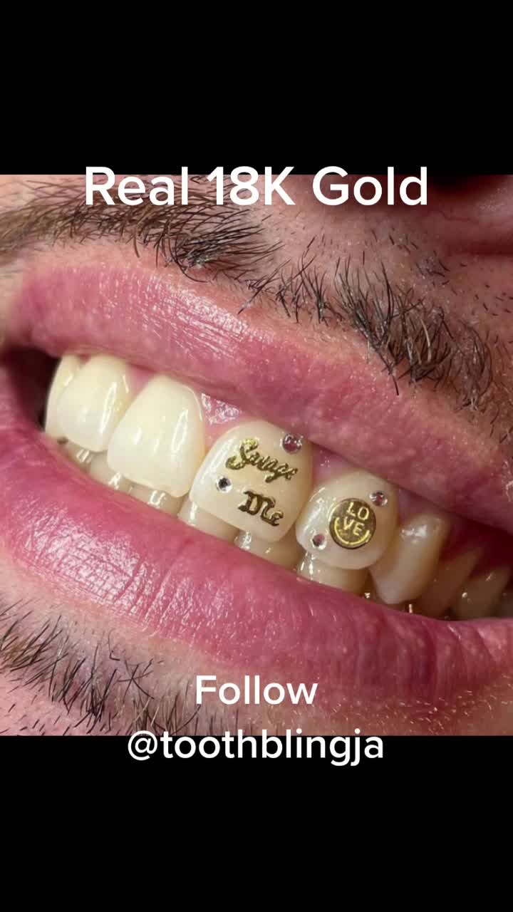 @ToothBlingJa
