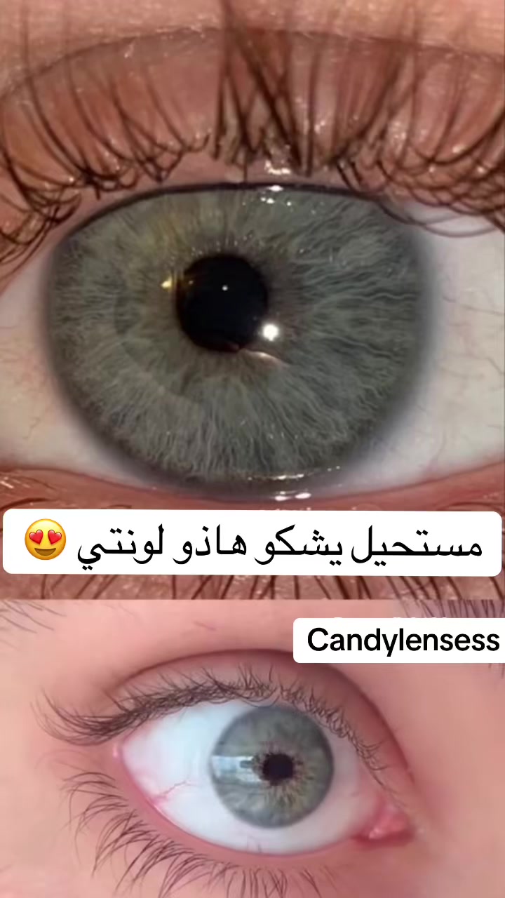 @Candy lensess