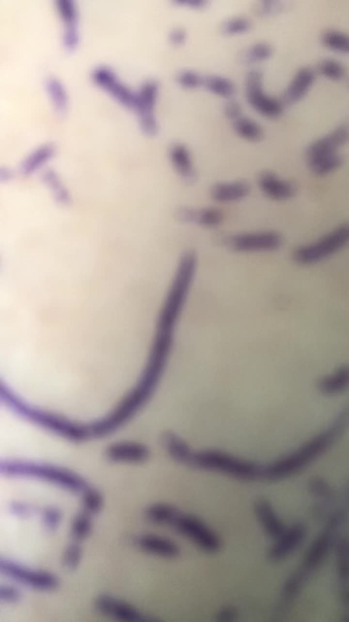 @Rxchmill
