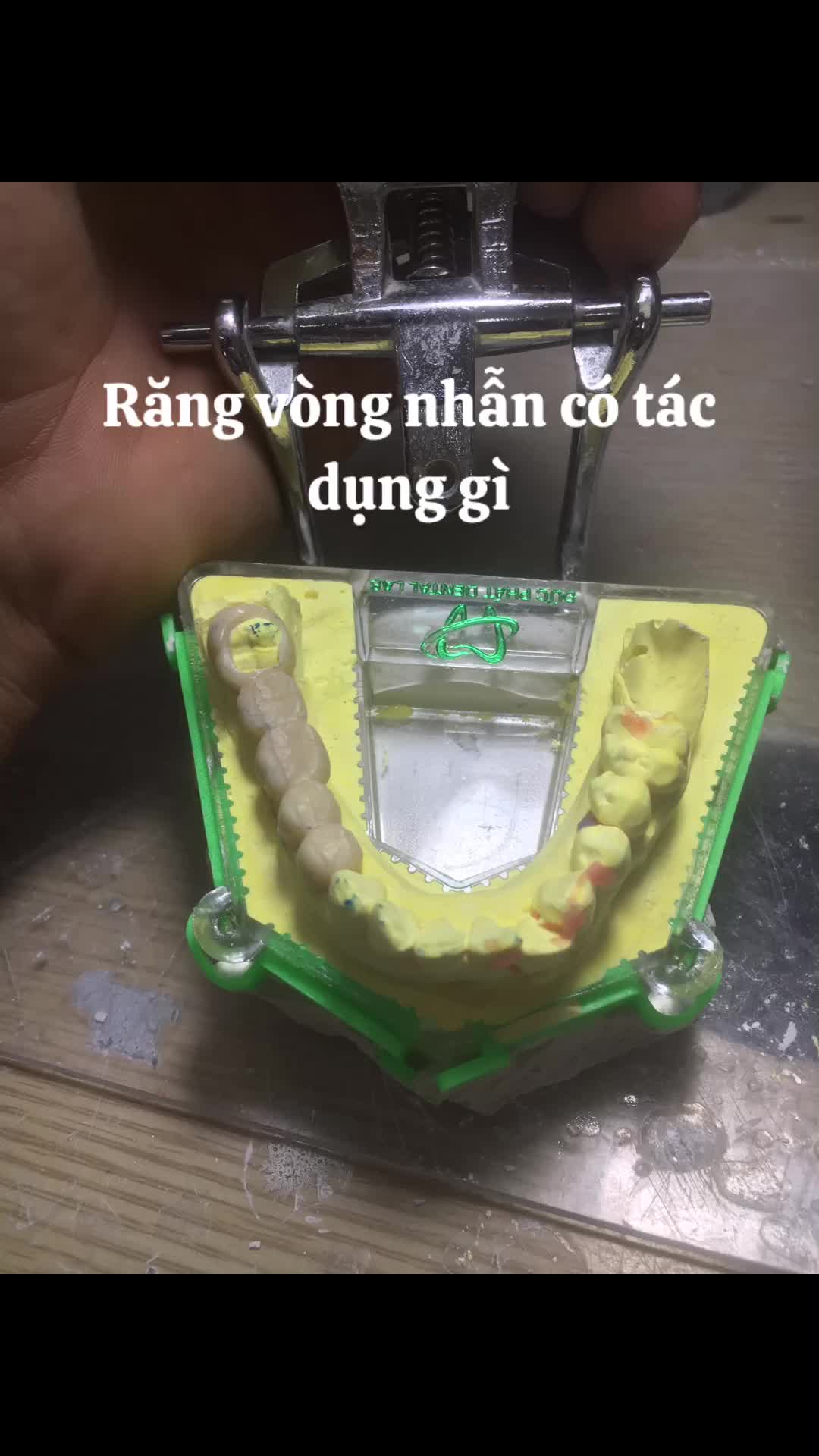@Hùng răng sứ 🦷🦷