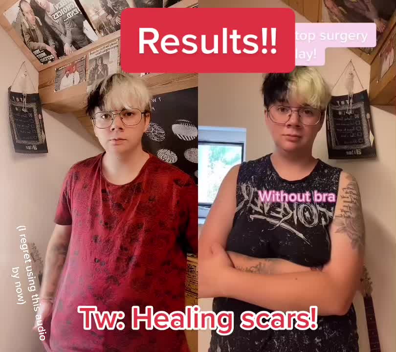 @Cosplayeroncrack