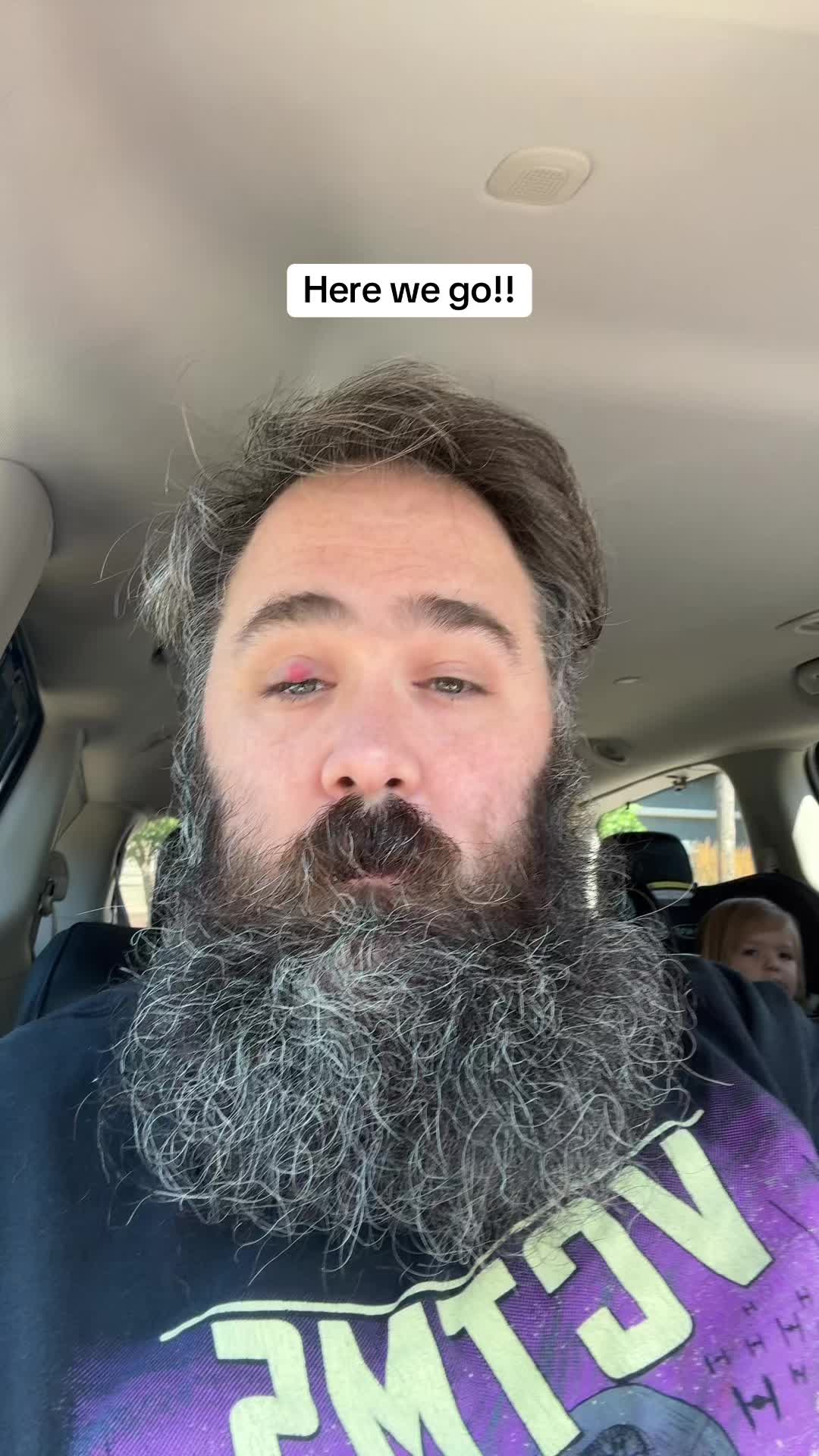 @James Conneally