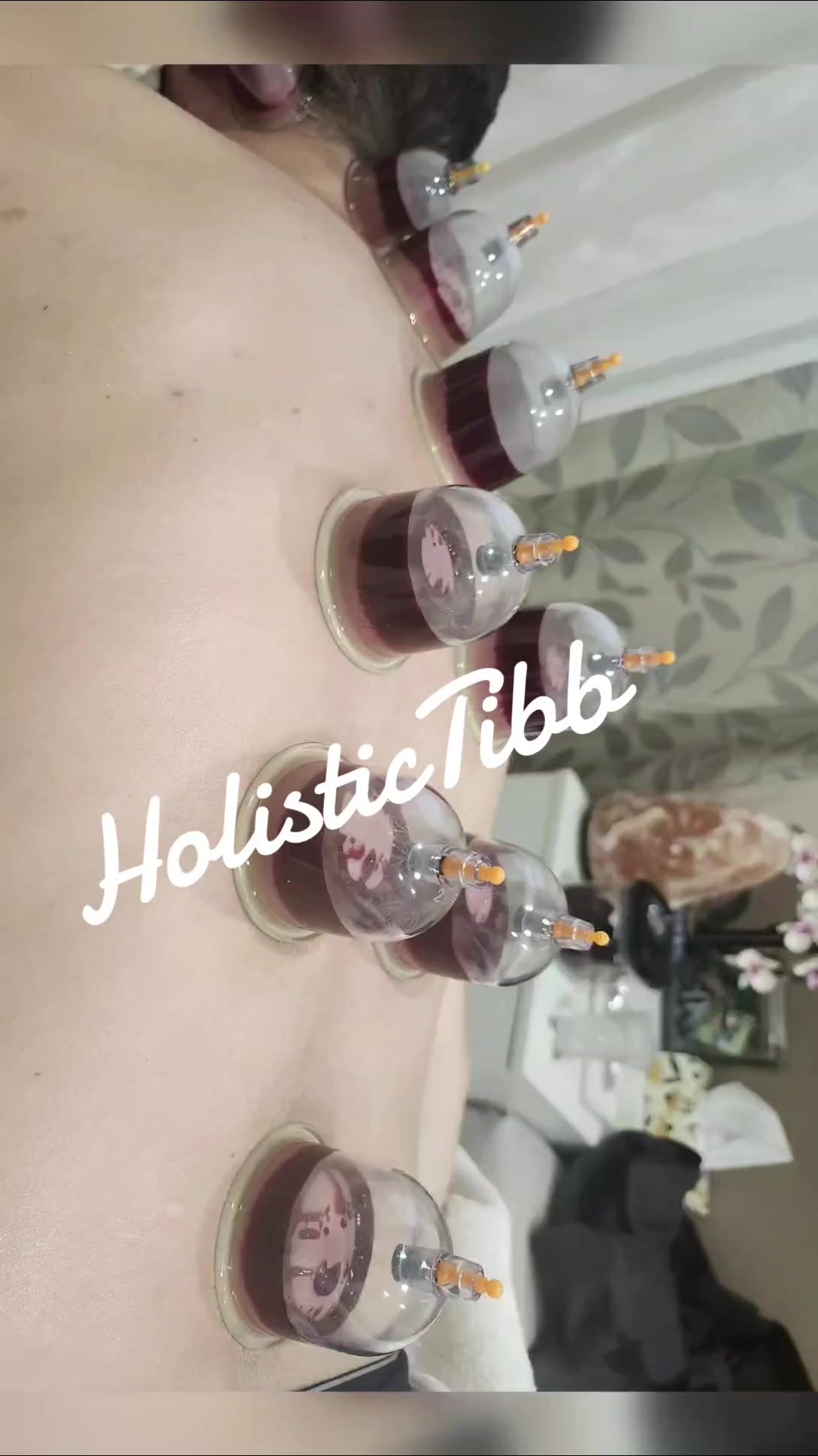 @Holistic Tibb Hijama