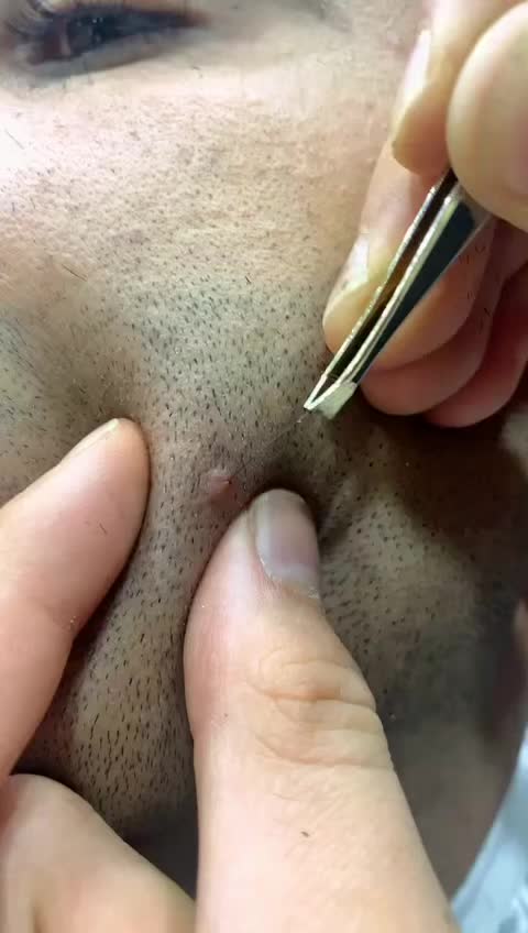 @Serdar işitir