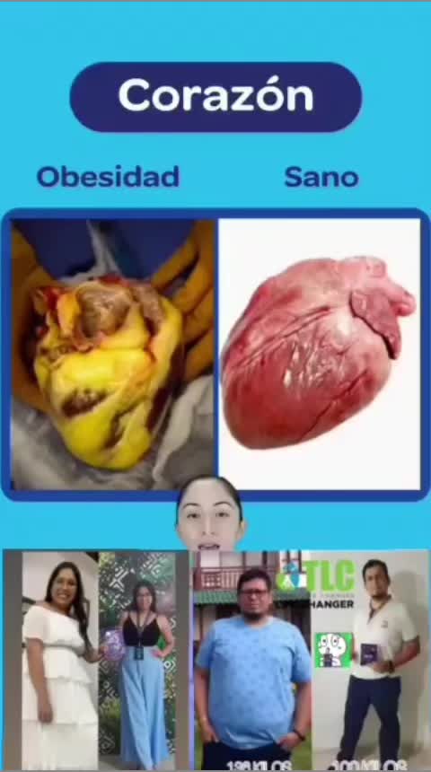 @Pierdepeso