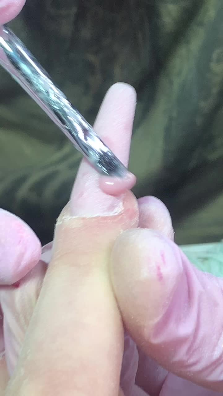 @A