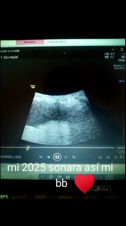 @chikitadominguez ๐ฅฐ๐ฅฐ๐