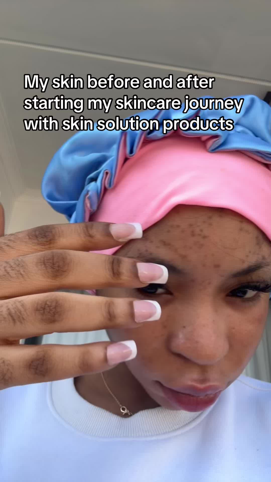 @Your skin solution🇳🇬🇬🇭🇬🇧