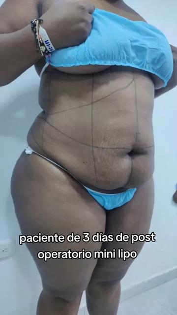 @Michell Mej&iacute;a