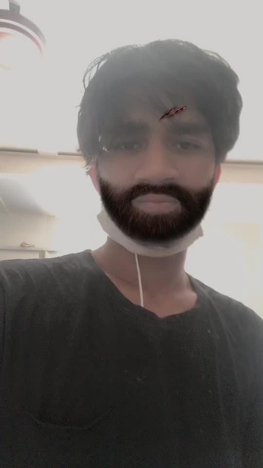 @Karthick manokaran