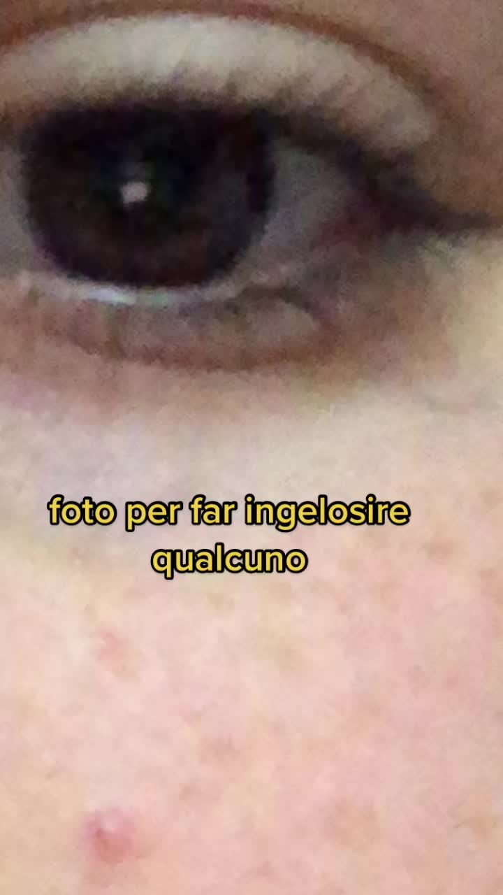 @fuckyou