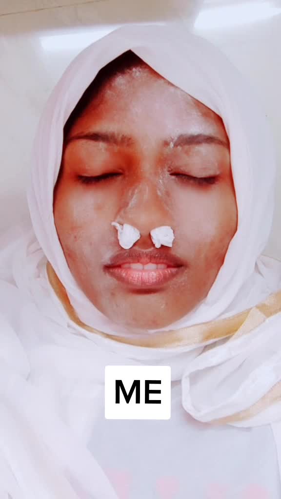 @Malaika Radhu