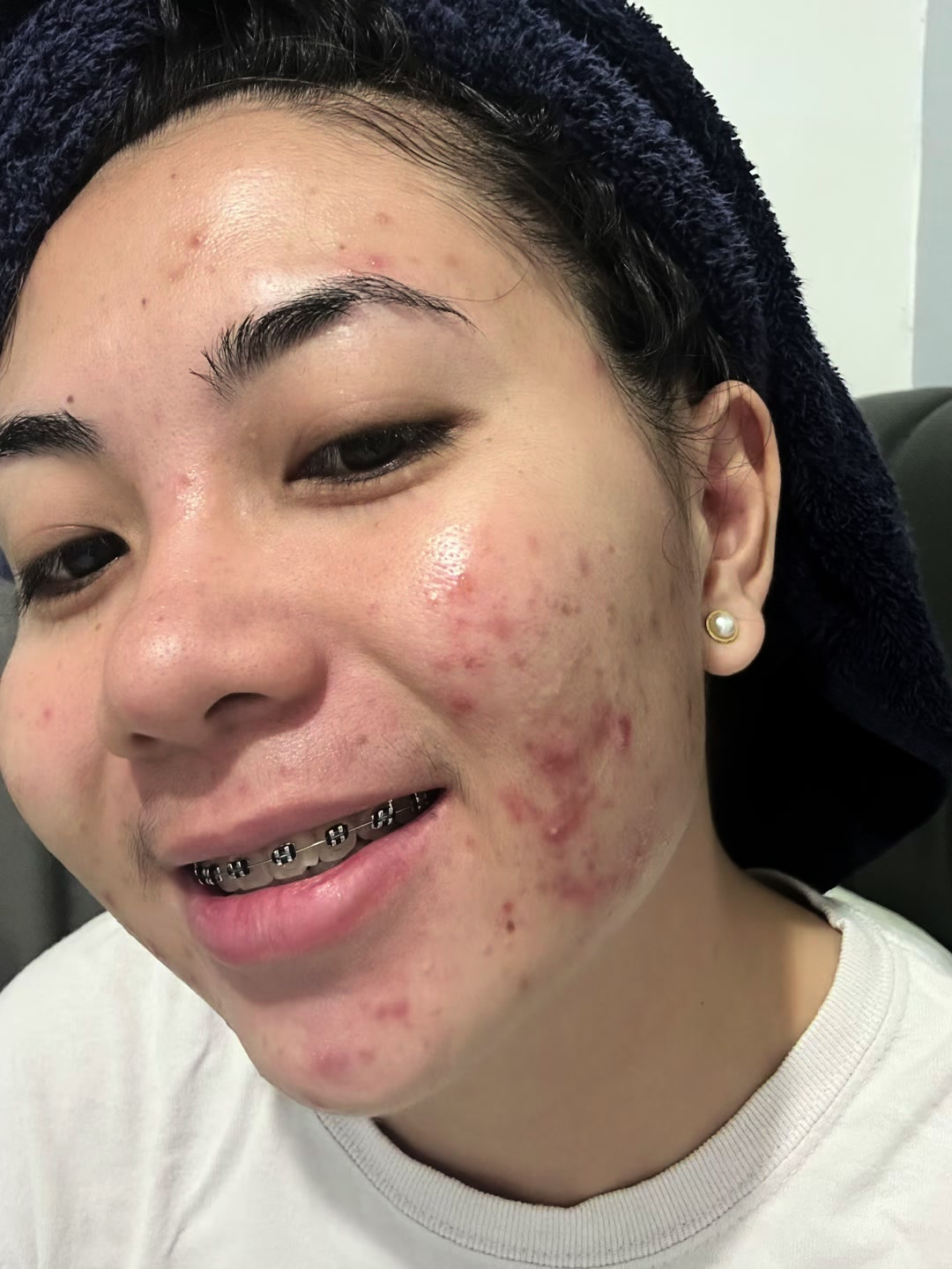 @Xianneshine 🇵🇭 🇨🇦