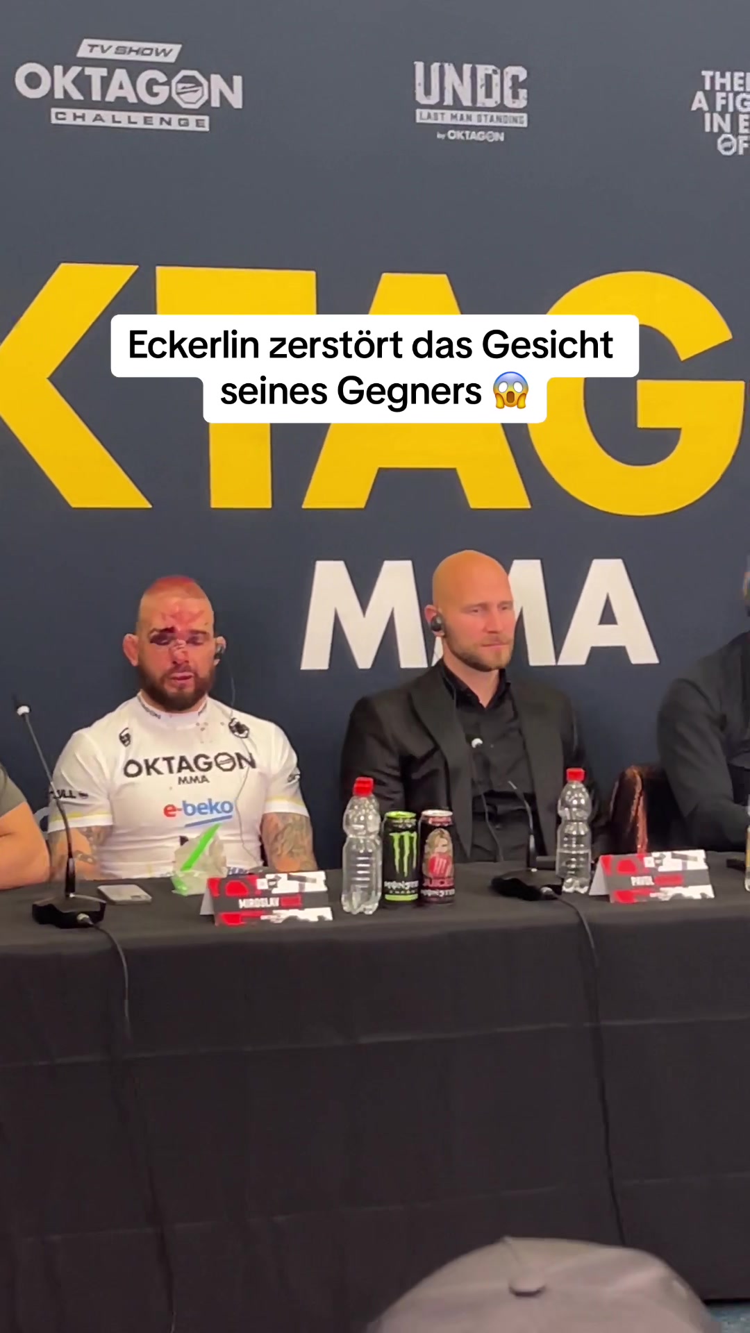 @NOTIMEMMA