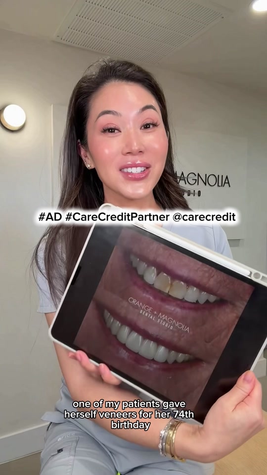 @Joycethedentist OC Veneers