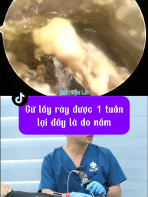 @Bs Hiệu Tai Mũi Họng Long Bi&ecirc;n