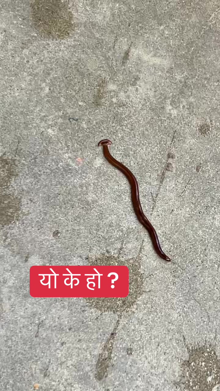 @RN Junu Poudel khadka 💉💊📔