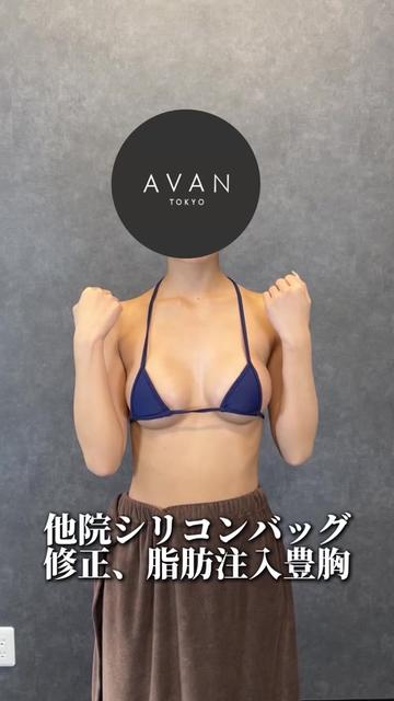 @森脇進/二の腕脂肪吸引・豊胸/AVAN TOKYO
