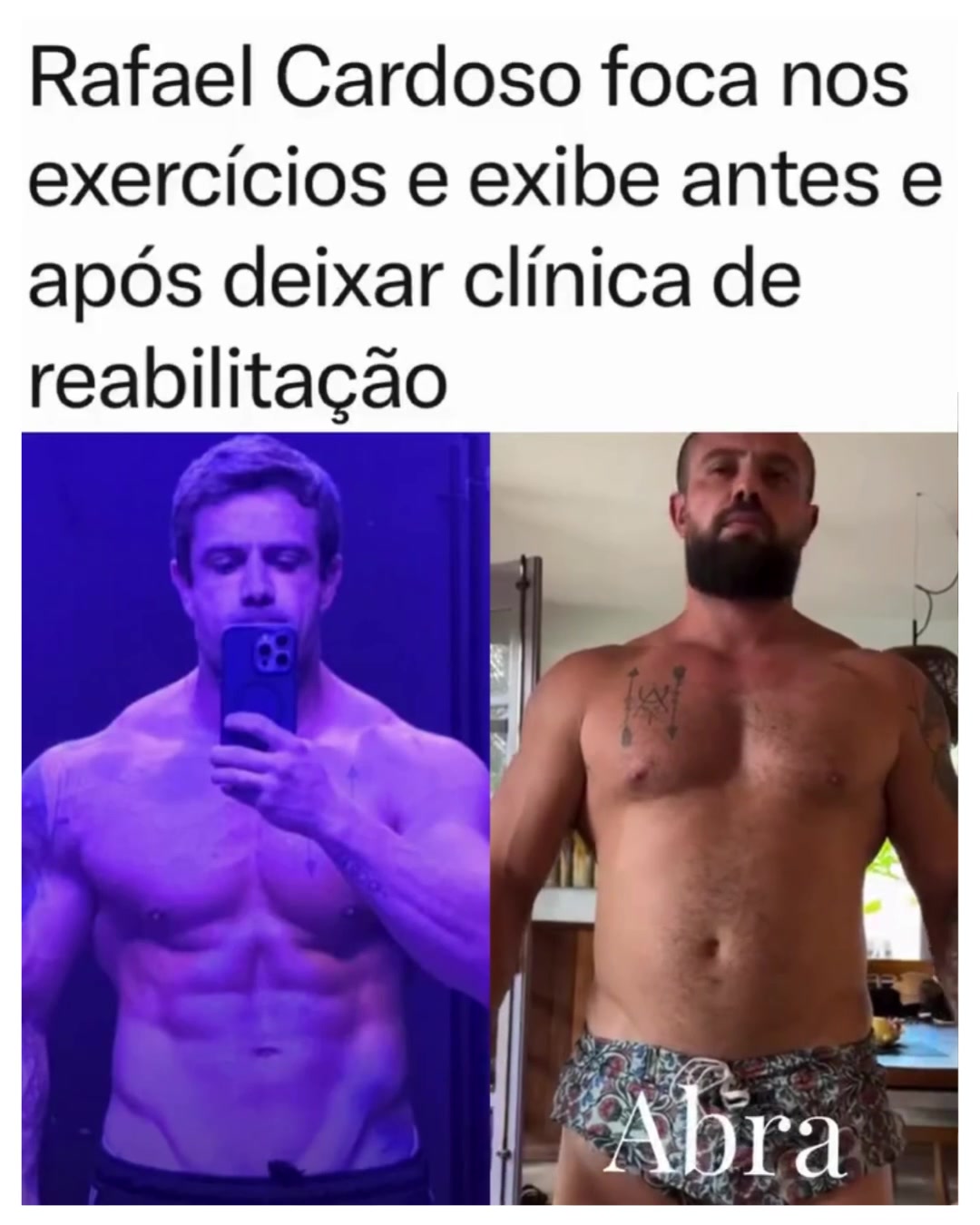 @Alfinetei