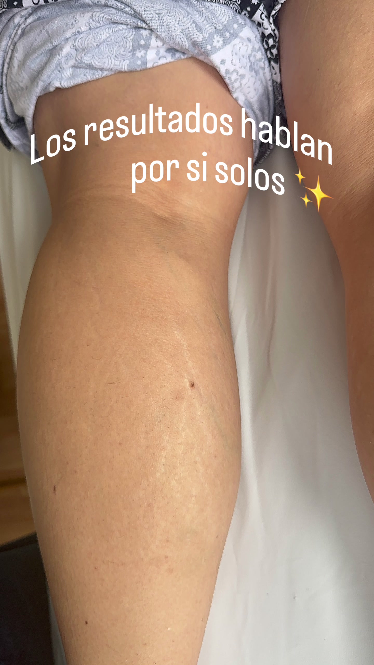 @Carla Panchana