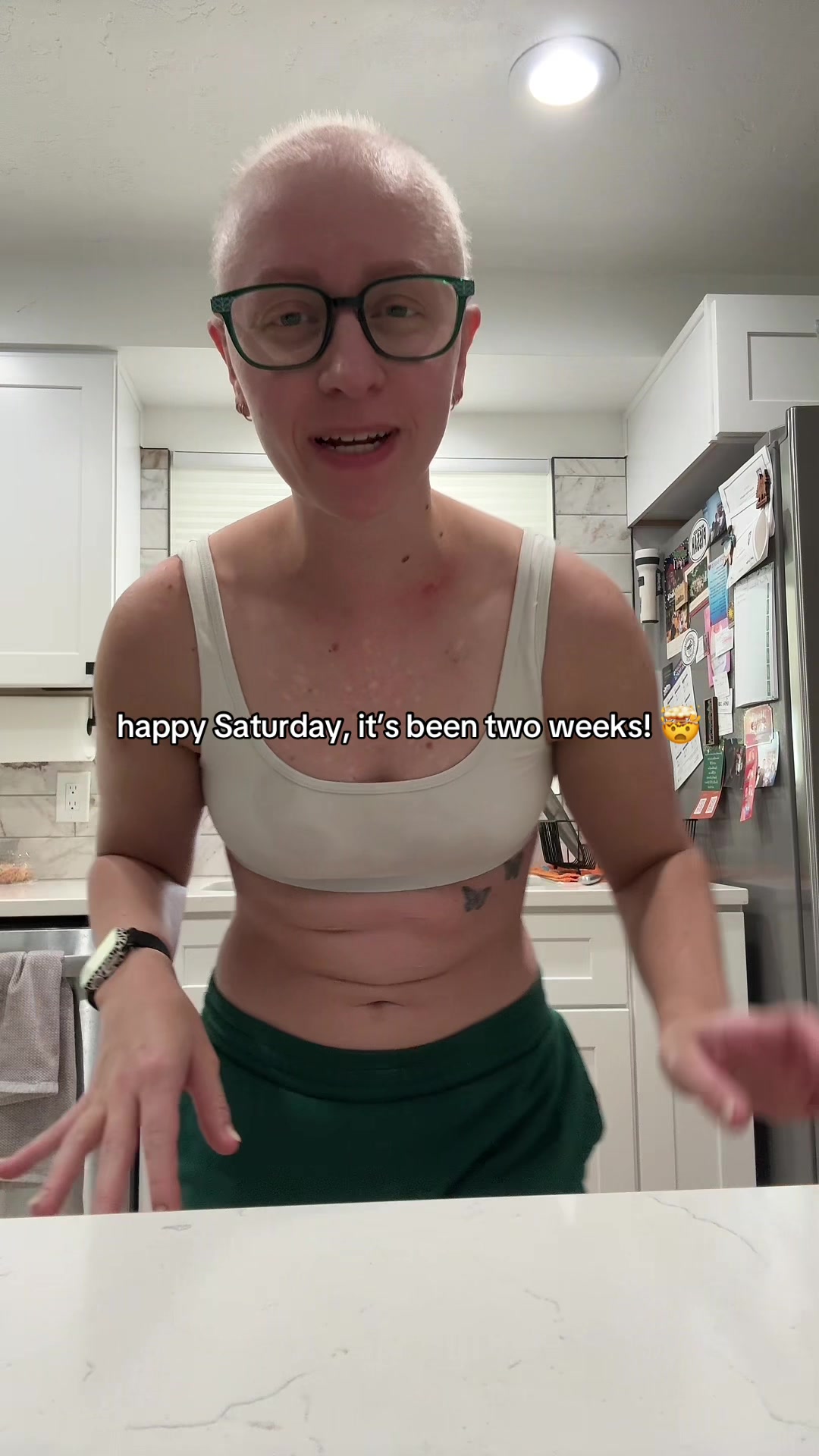 @KK’s lupus journey!