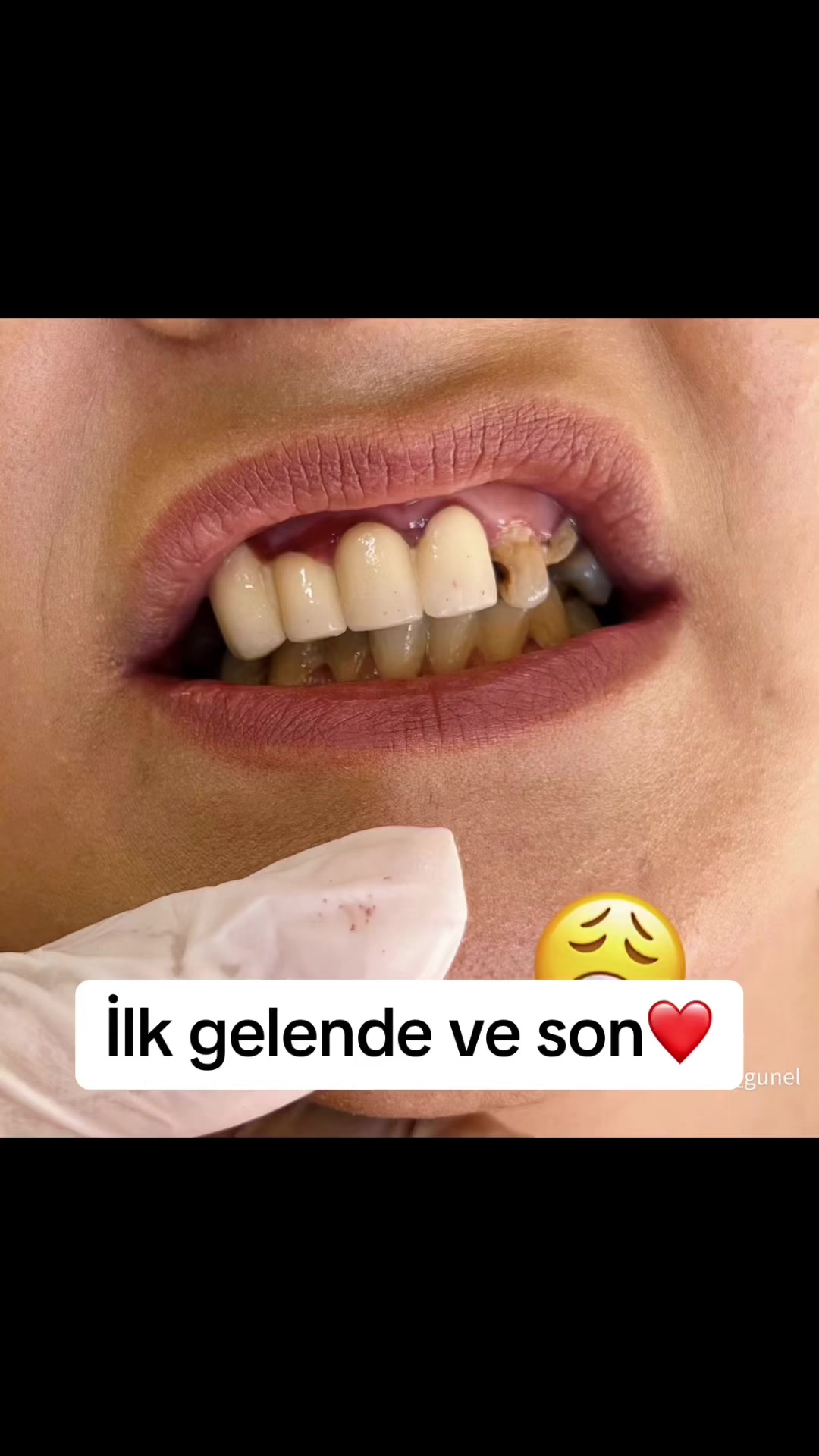 @Dentist_Günel