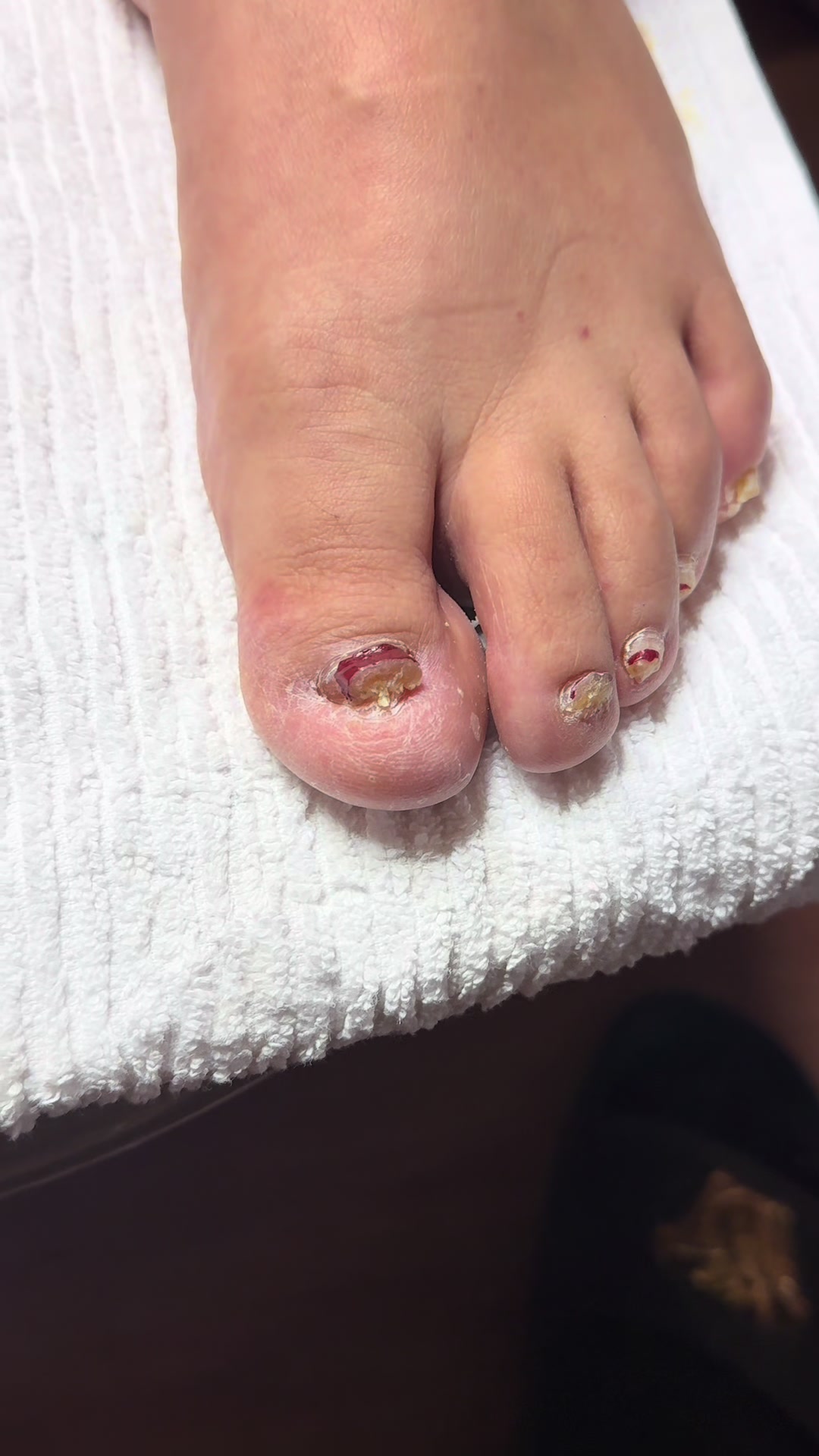 @ToesbyKoki